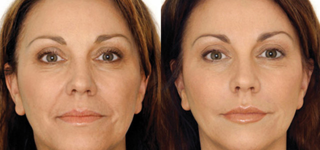 mtoki2.jpg mtoki2.jpg